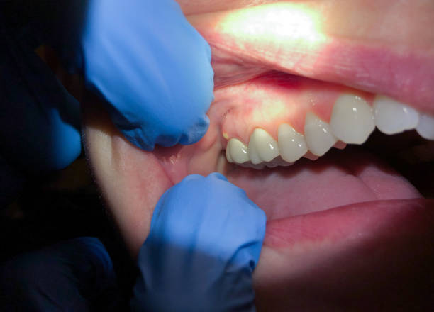 Best Emergency Dental Care for Trauma or Injury in Sterling, VA