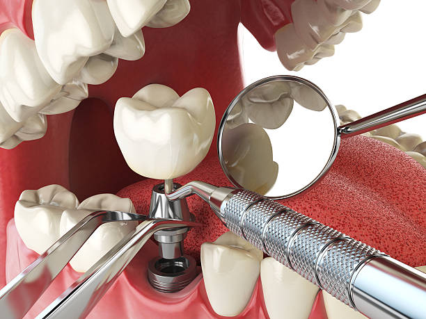 Best Emergency Dental Care for Trauma or Injury in Sterling, VA