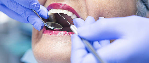 Best Emergency Tooth Extraction in Sterling, VA